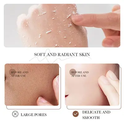 Exfoliator Exfoliating Gel thumbnail 2