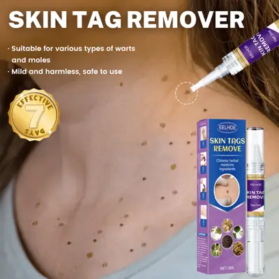Skin Tag Mole Wart Remover Pen